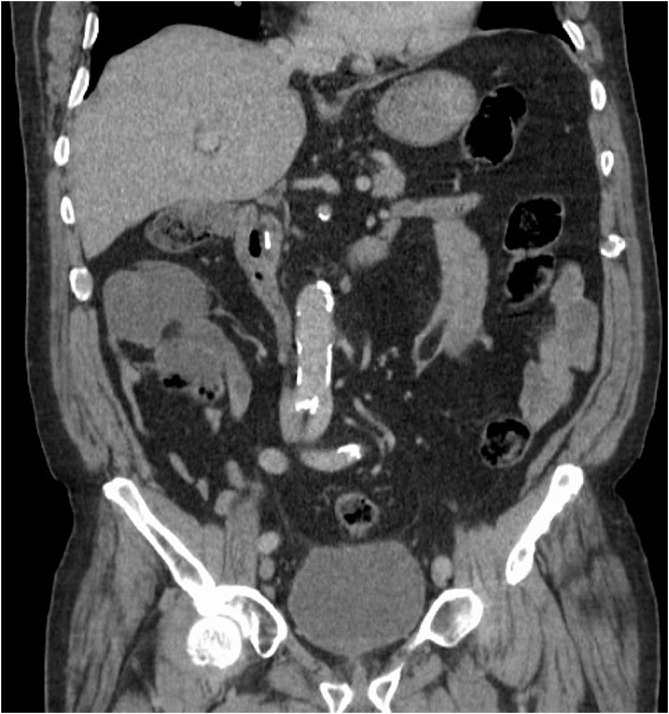 PMC7481483 – fig0005