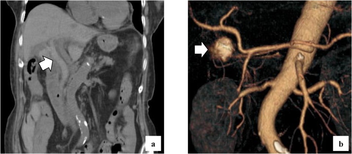 PMC7677667 – fig0005