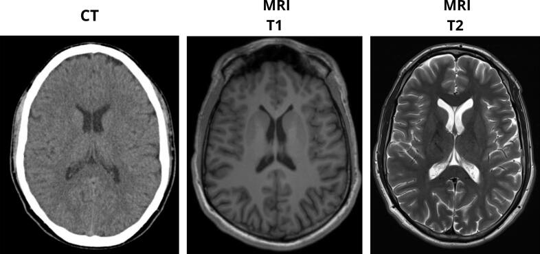 PMC13020055 – f0010