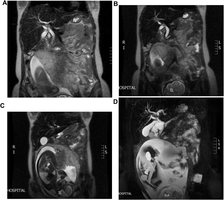 PMC6626975 – fig0010