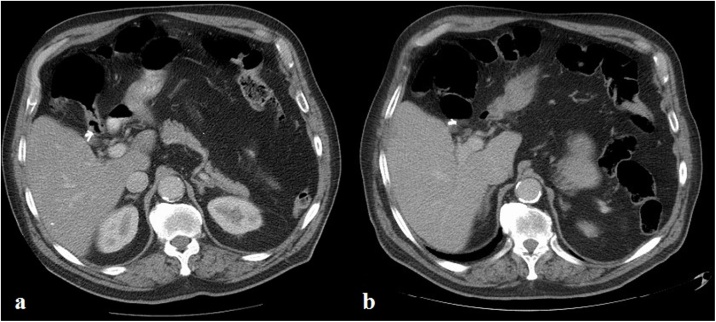 PMC7481483 – fig0010