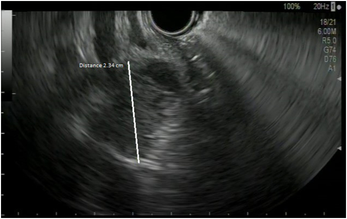 PMC8605256 – f0010