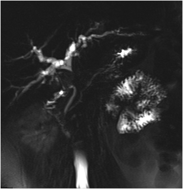 PMC8114107 – f0010