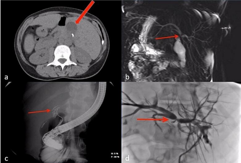 PMC10831892 – f0010