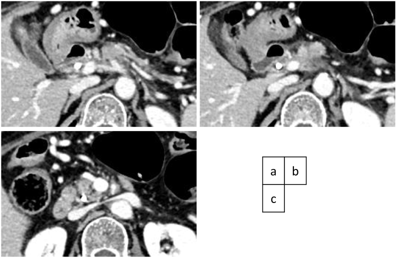 PMC8850749 – f0015