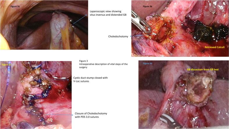 PMC12005859 – f0015