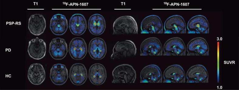 PMC9307942 – f0020