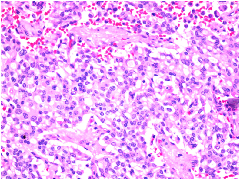 PMC8114107 – f0020