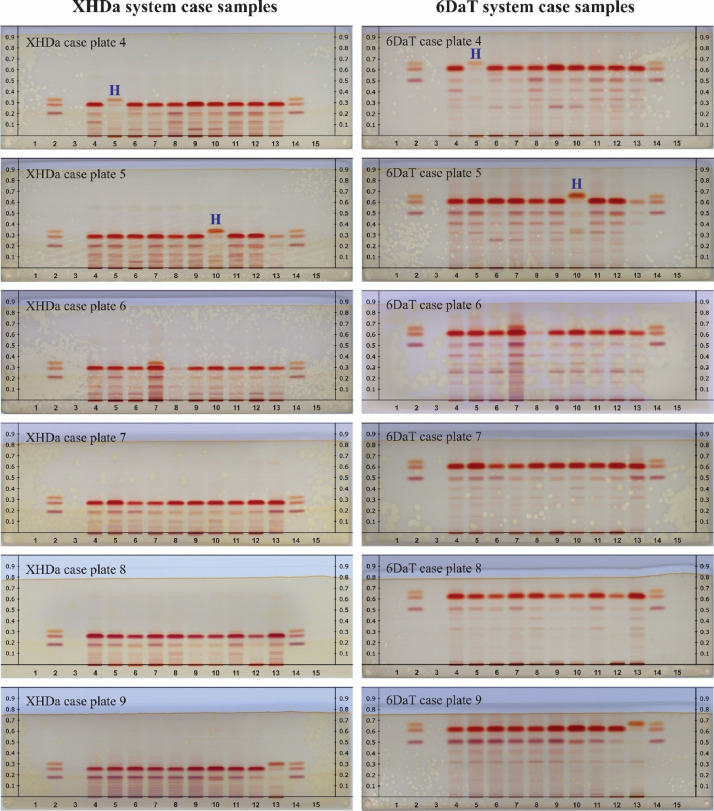 PMC7352075 – fig0004