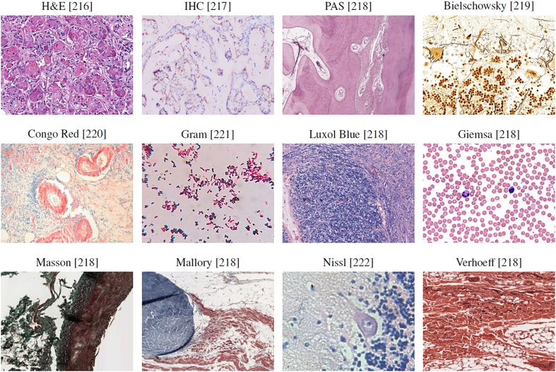 PMC10900832 – f0025