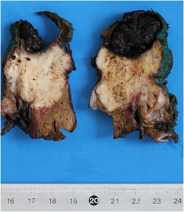 PMC8605256 – f0025