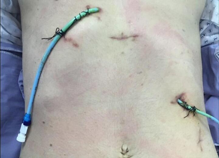 PMC10831892 – f0025