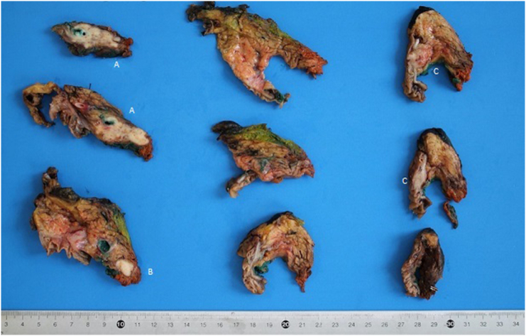 PMC8605256 – f0030