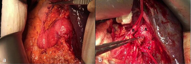 PMC10831892 – f0030