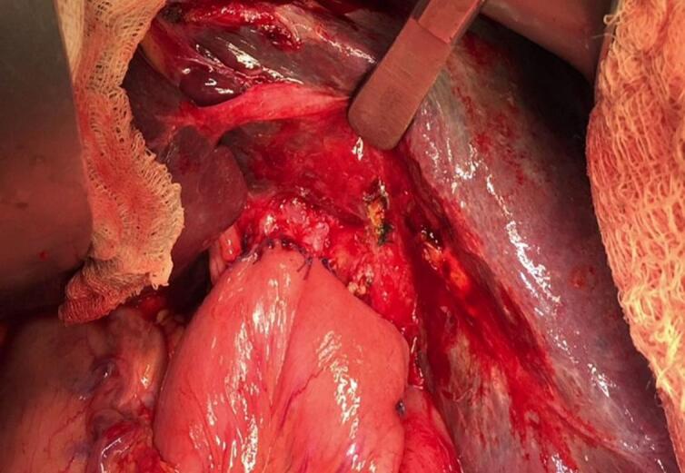 PMC10831892 – f0035