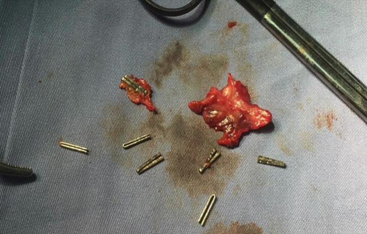 PMC10831892 – f0040