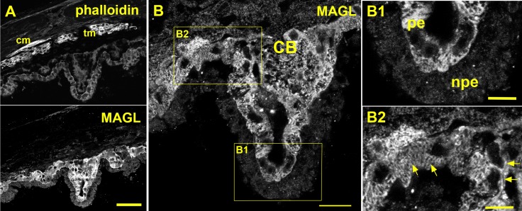 PMC4961057 – i1552-5783-57-7-3287-f04