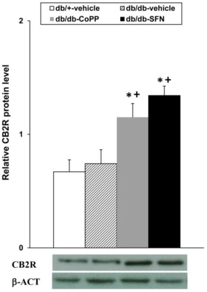 PMC5713238 – ijms-18-02268-f006