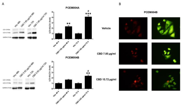 PMC7432565 – ijms-21-05409-f011