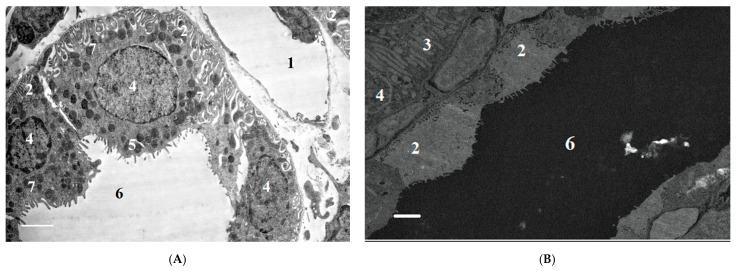 PMC8709234 – ijms-22-13625-f011