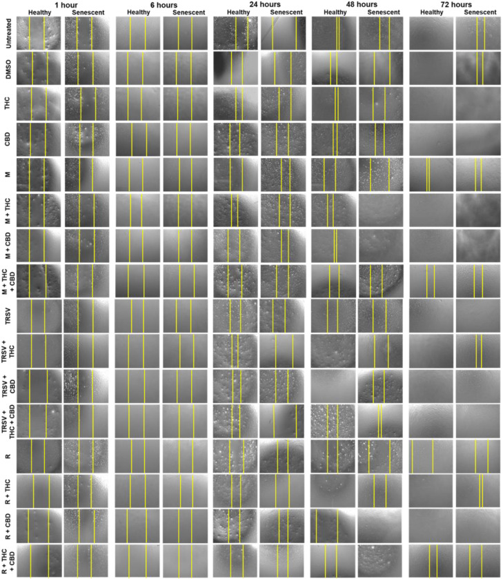 PMC9368899 – ijms-23-08804-f004