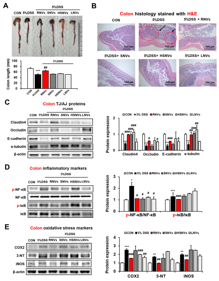 PMC9456148 – ijms-23-09955-f003