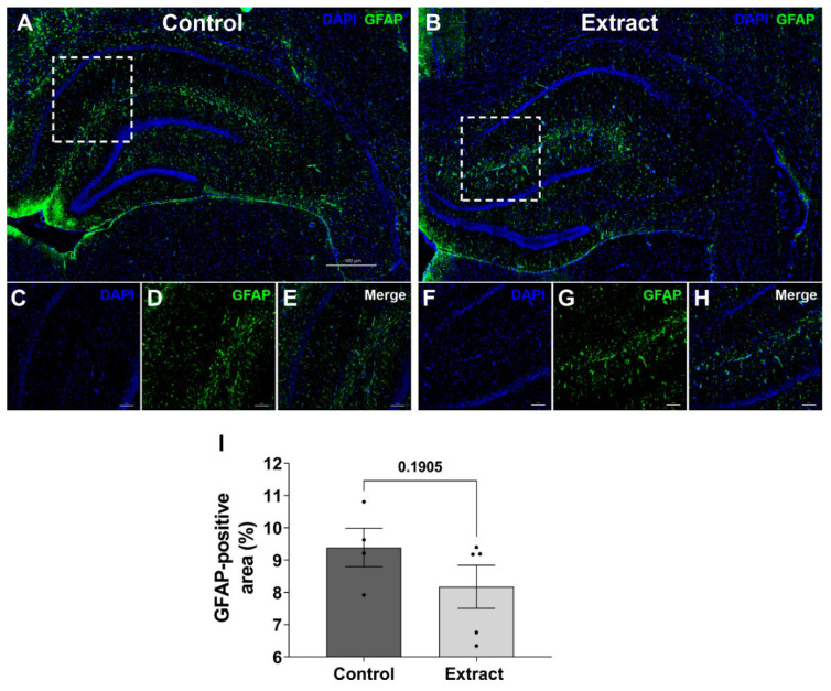PMC10380262 – ijms-24-11775-f004
