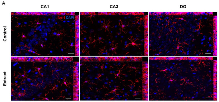 PMC10380262 – ijms-24-11775-f005
