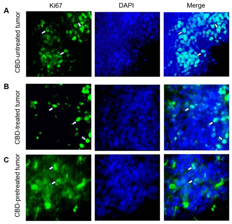 PMC10488207 – ijms-24-13235-f004