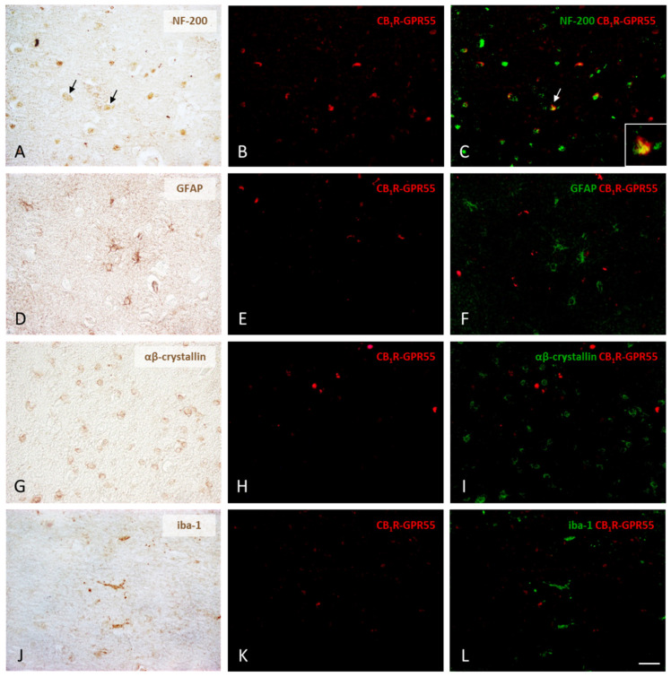 PMC11050292 – ijms-25-04176-f003