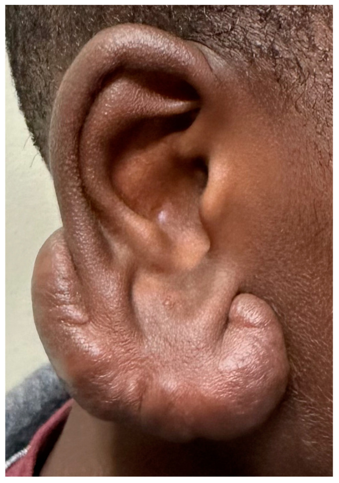 PMC11241632 – ijms-25-07137-f006