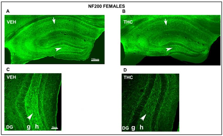 PMC11242182 – ijms-25-07453-f011