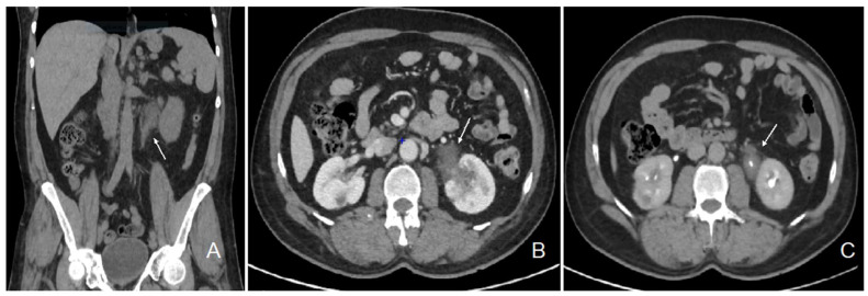 PMC11311393 – ijms-25-08166-f001