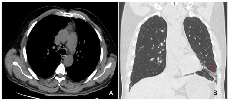 PMC11311393 – ijms-25-08166-f003