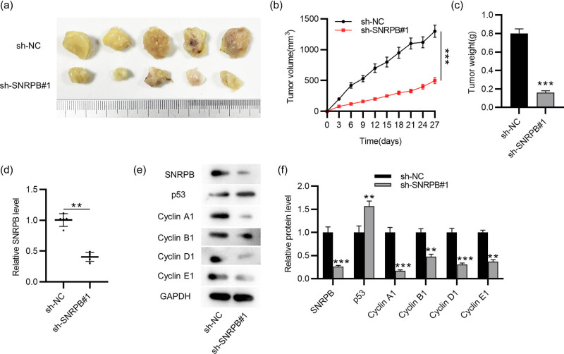PMC9579862 – j_med-2022-0531_fig_005