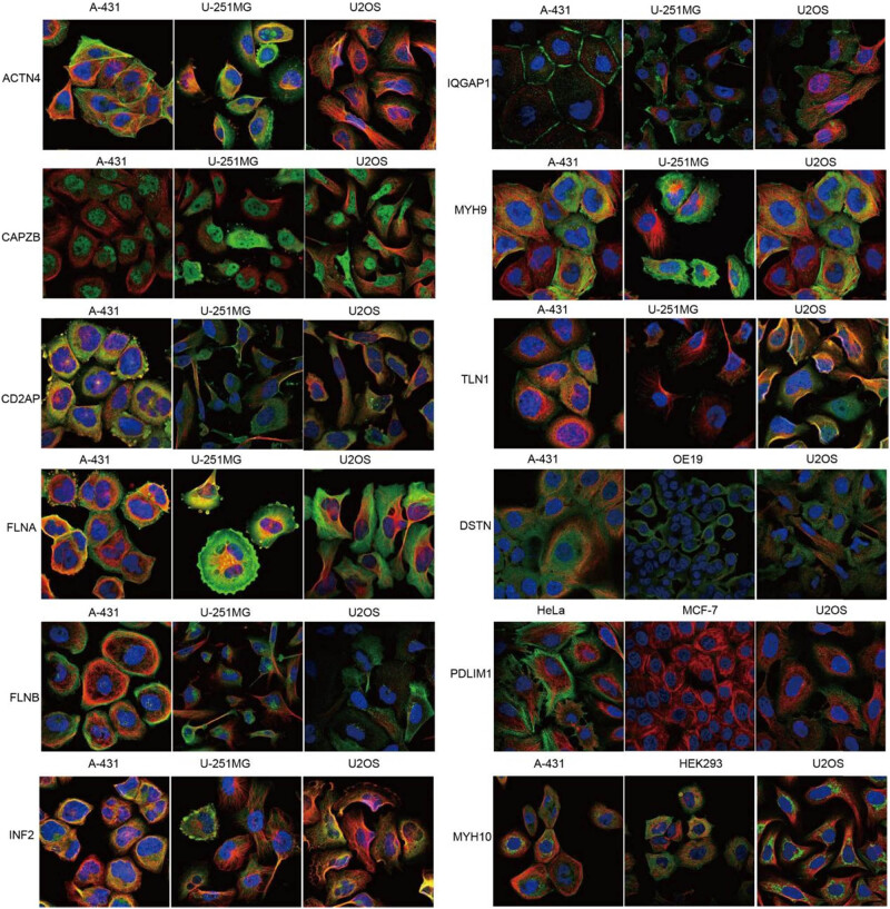 PMC10997004 – j_med-2024-0929_fig_005