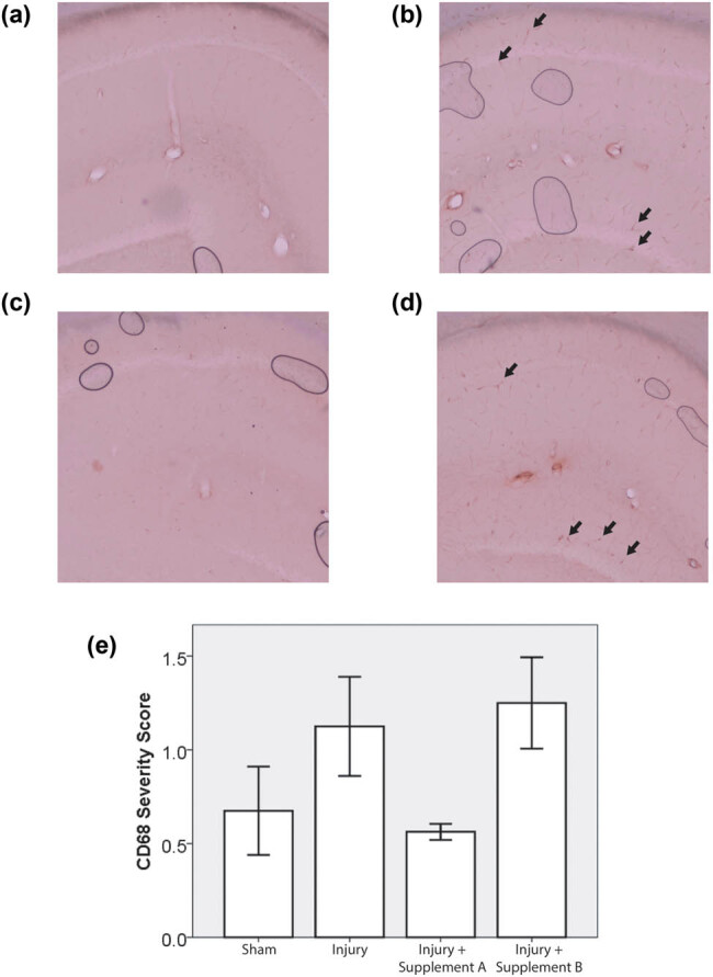 PMC7885303 – j_tnsci-2021-0010_fig_002