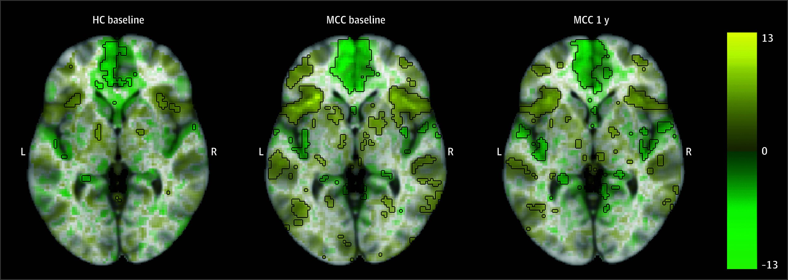 PMC11411392 – zoi241023f1