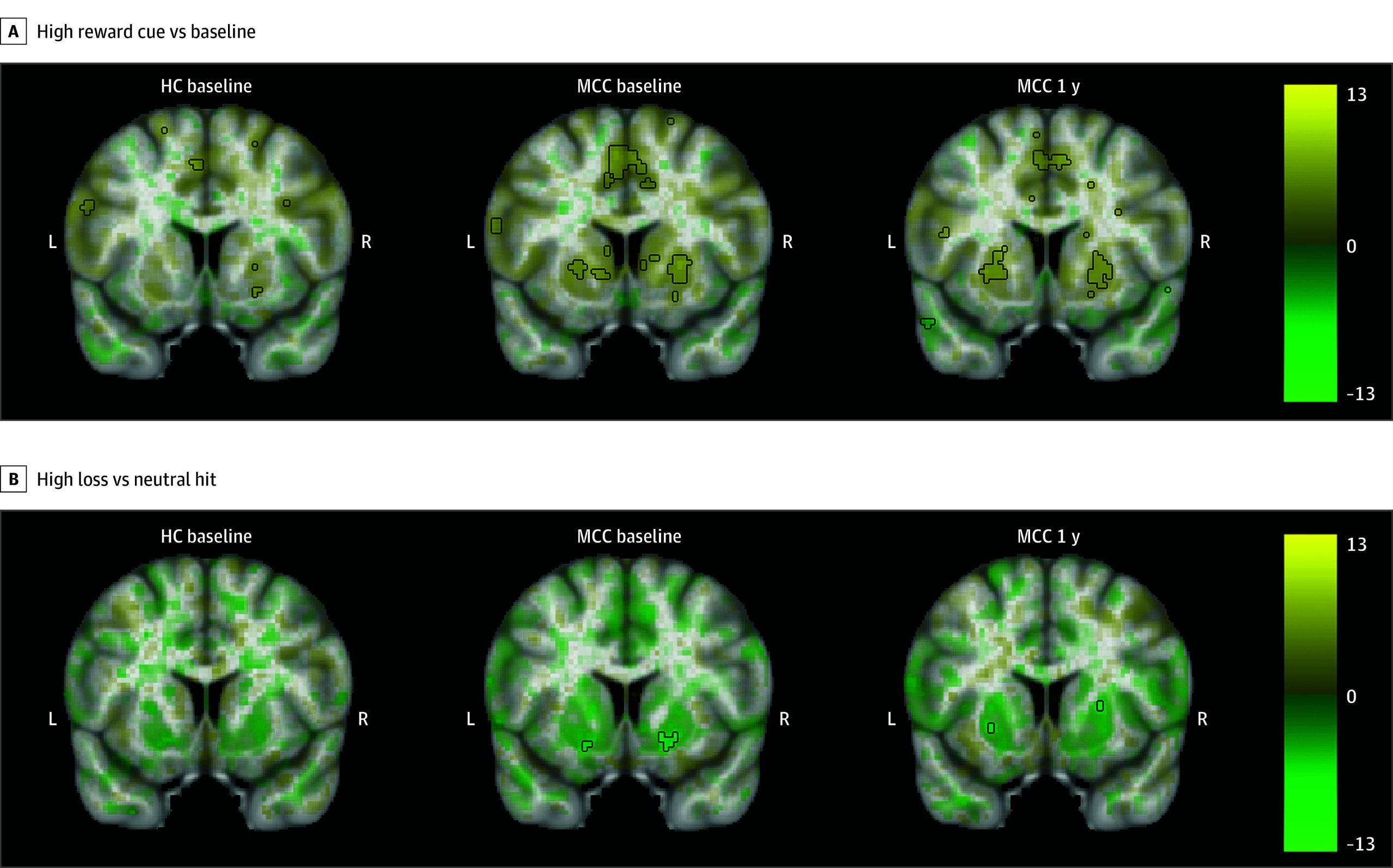PMC11411392 – zoi241023f2