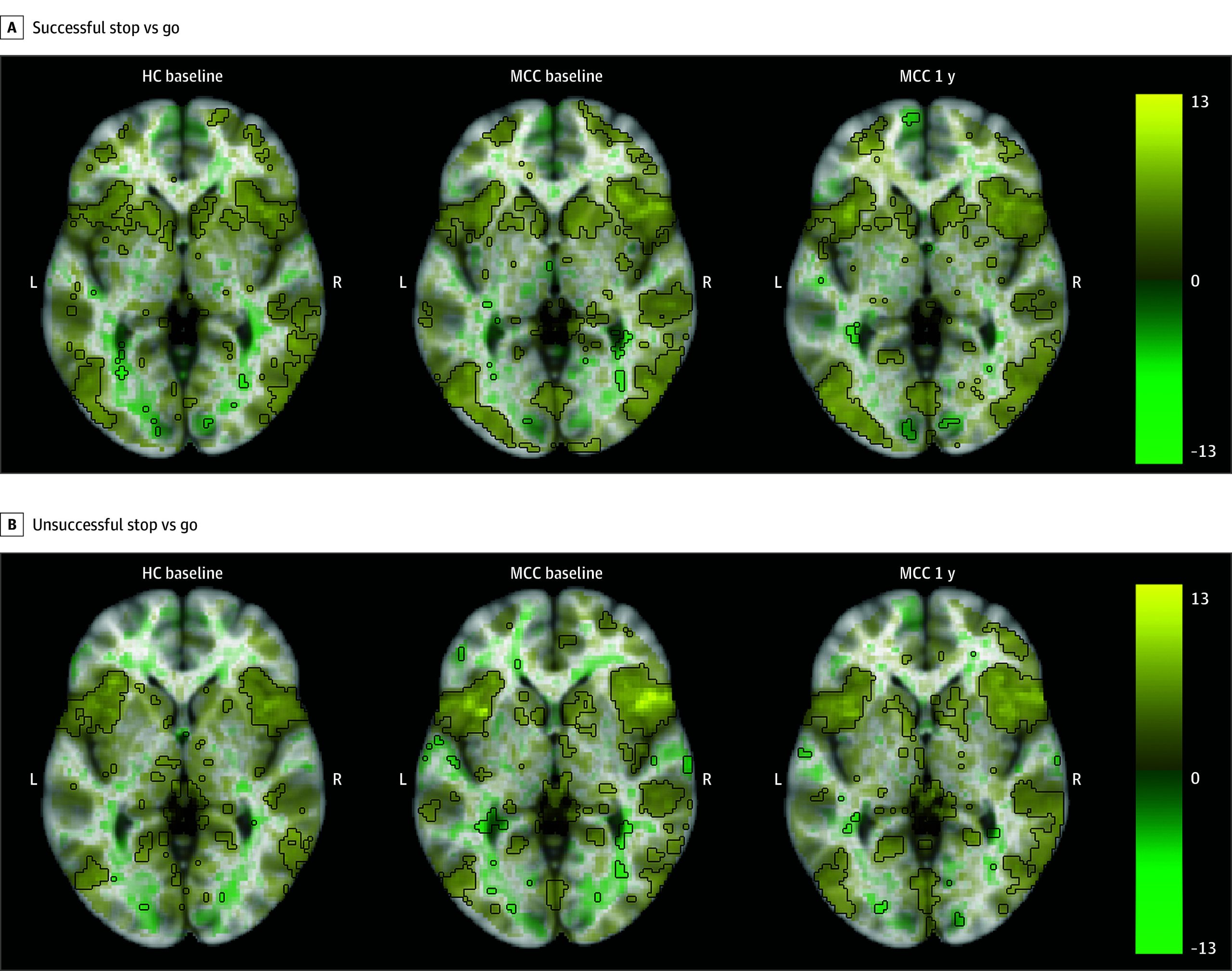 PMC11411392 – zoi241023f3