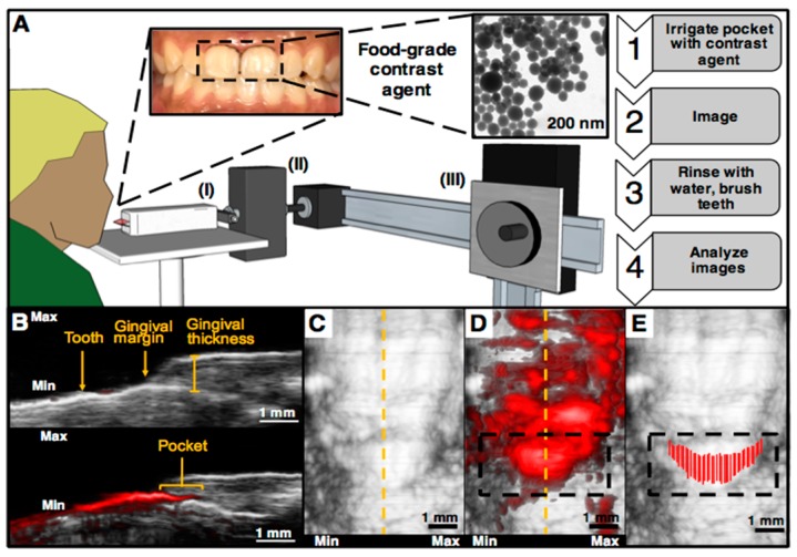 PMC6406263 – jcm-08-00166-f004