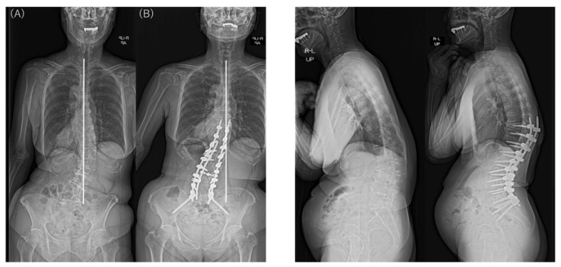 PMC10052673 – jcm-12-02389-f005