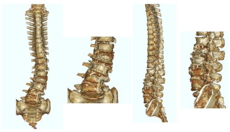 PMC10052673 – jcm-12-02389-f006