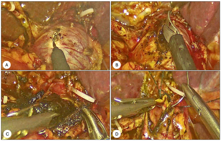 PMC11856840 – jcm-14-01310-f003