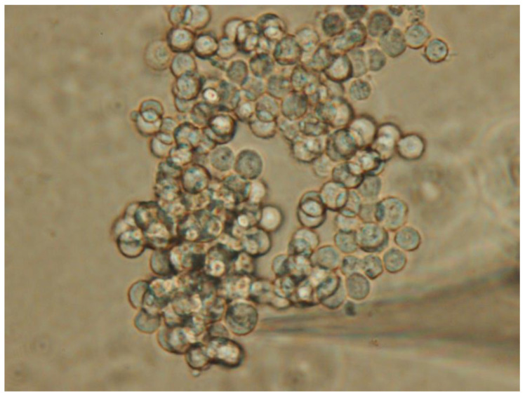 PMC12072979 – jcm-14-03117-f001