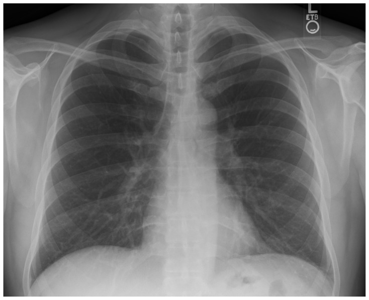 PMC11801492 – f1-jetem-10-1-o1