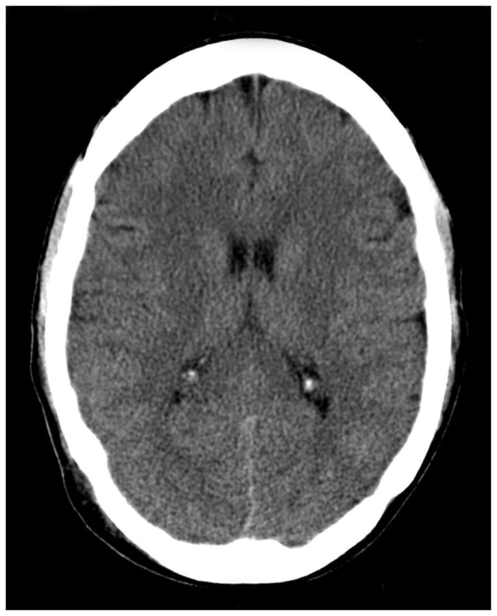 PMC11801492 – f2-jetem-10-1-o1