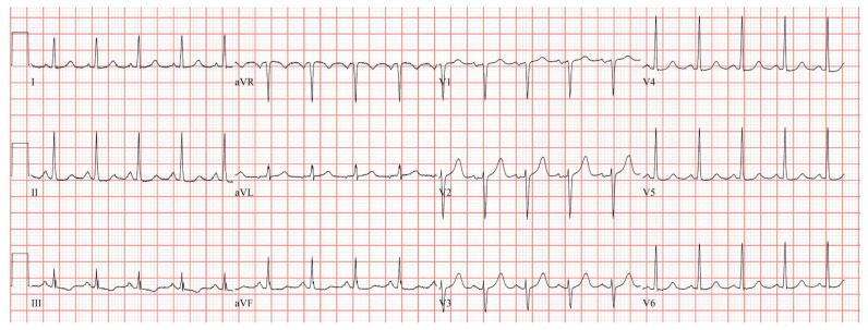 PMC11801492 – f3-jetem-10-1-o1