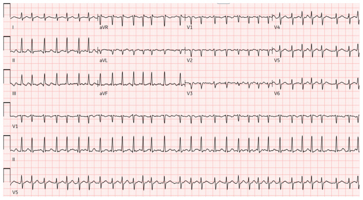 PMC12782603 – f1-jetem-10-5-ce260