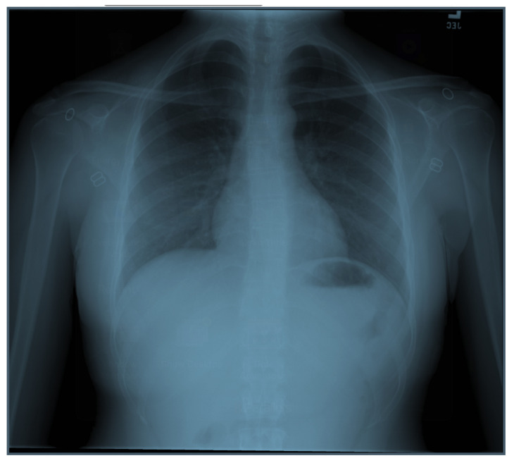 PMC12782603 – f2-jetem-10-5-ce260